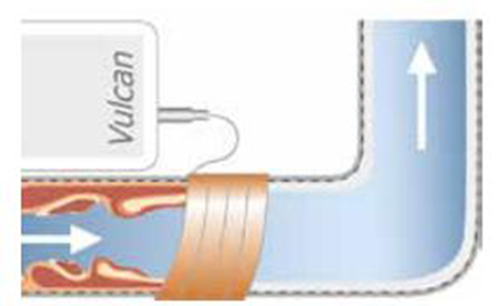 原來沃肯電脈沖阻垢系統(tǒng)是這樣清除水垢的